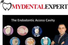 Endodontic Access Cavity 30 min (EN) | MYDENTALEXPERT